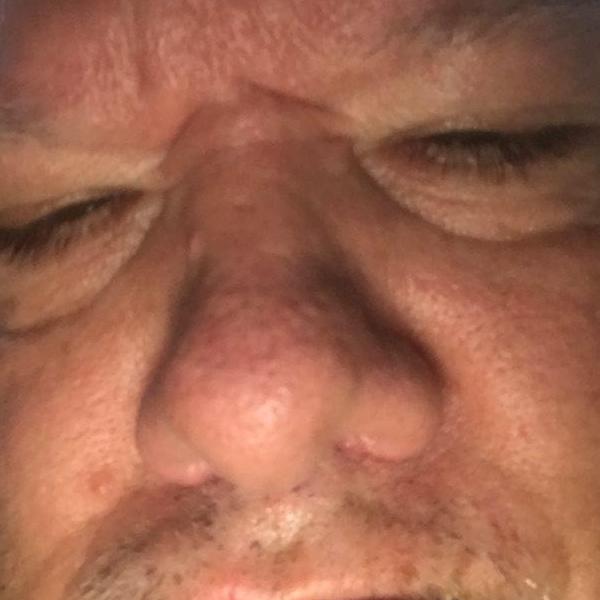 DONNIE